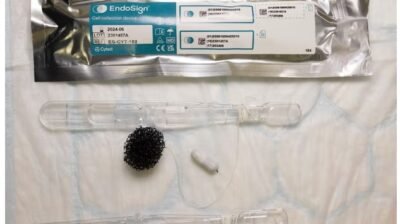 ক্যান্সার শনাক্তে হাই-স্ট্রিট ফার্মেসিতে শুরু হচ্ছে ‘স্পঞ্জ অন আ স্ট্রিং’ পরীক্ষা